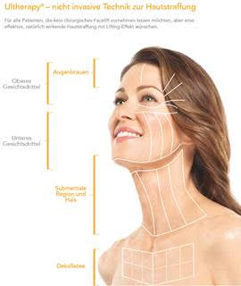Facial treatment with Ultherapy