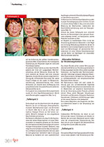 Artikel 'Komplikationen durch permanente Filler im Gesicht - Alternativen'