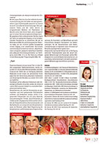 Artikel 'Komplikationen durch permanente Filler im Gesicht - Alternativen'