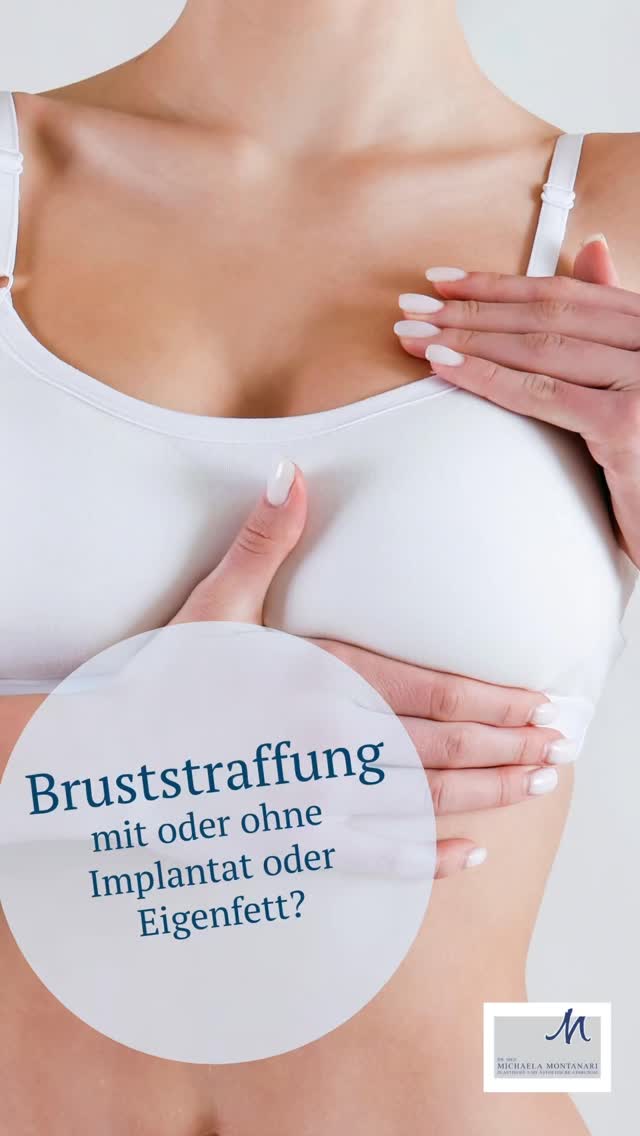 Eine Bruststraffung hebt und formt die Brust – doch sie vergrößert das Volumen nicht. Implantate kommen dann ins Spiel, wenn zusätzlich zur Straffung mehr Fülle oder Projektion gewünscht wird.   Implantate können sinnvoll sein, wenn: das natürliche Brustvolumen nach ▪️Gewichtsverlust, Schwangerschaft oder Alter deutlich abgenommen hat ▪️der obere Brustbereich sehr flach wirkt ▪️eine straffere Form gewünscht ist, die allein mit Eigengewebe nicht stabil erreicht werden kann ▪️gleichzeitig eine sichtbare Vergrößerung erzielt werden soll   Es gibt mehrere Möglichkeiten: ▫️Straffung ohne Implantat: ideal bei ausreichendem Eigengewebe ▫️Straffung mit Implantat: für mehr Volumen oder stärkere Projektion ▫️Hybrid-Ansatz (Implantat + Eigenfett): für besonders natürliche Übergänge   ➡️Welche Option geeignet ist, hängt immer von Ausgangssituation, Gewebequalität und gewünschtem Ergebnis ab. Wir beraten Sie gerne ausführlich zu diesem Thema!   #bruststraffung #brustverkleinerung #brustaugmentation #brustvergroesserung #silikonimplantate #eigenfett #beauty #breastsurgery #brustop #aestheticexpert #plasticsurgery #aesthetischechirurgie  #plasticsurgery #bochum #ruhrpott